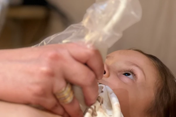 Mãos da médica operando a sonda do equipamento de imagem em destaque com parte do rosto de uma criança visível ao fundo.